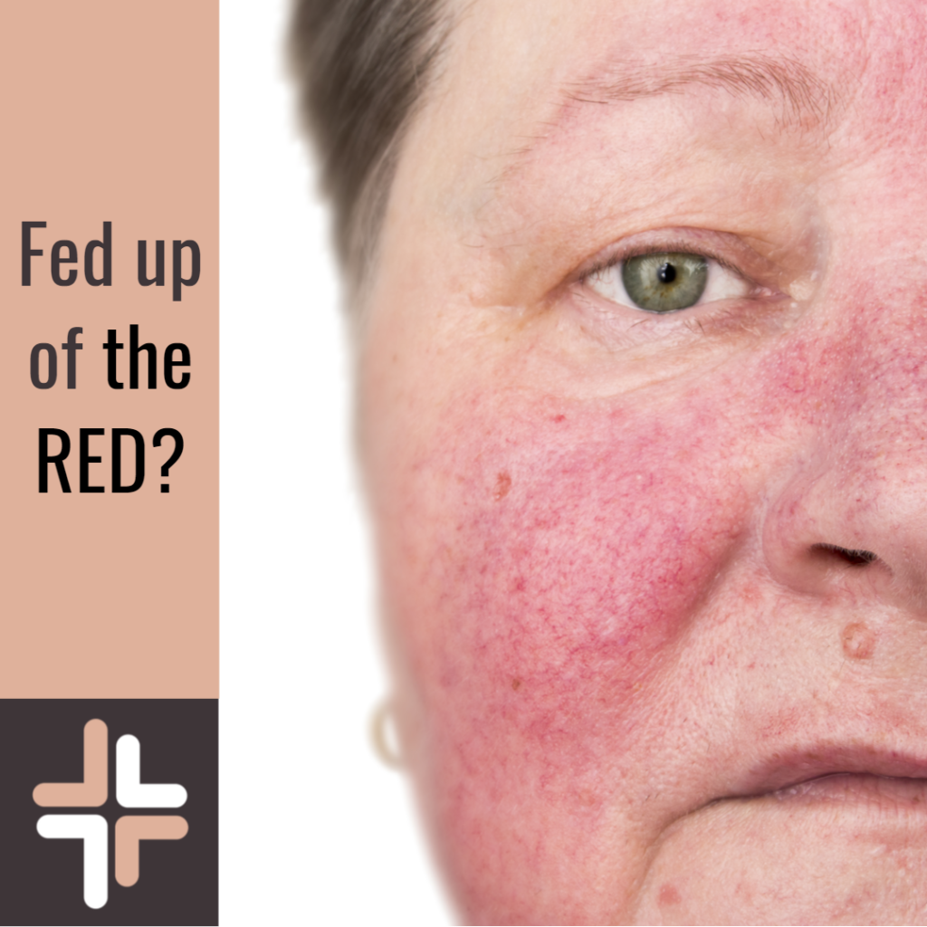 Acne Skin Care & Treatments 3 Red